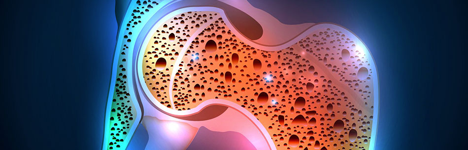 Attività fisica e osteoporosi