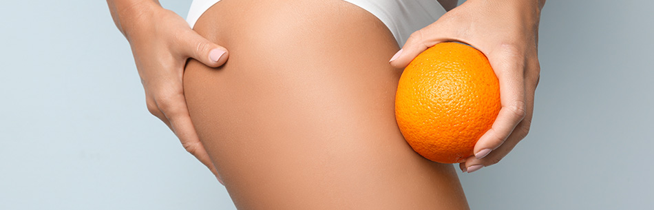 Allenamento e salute: come combattere la cellulite